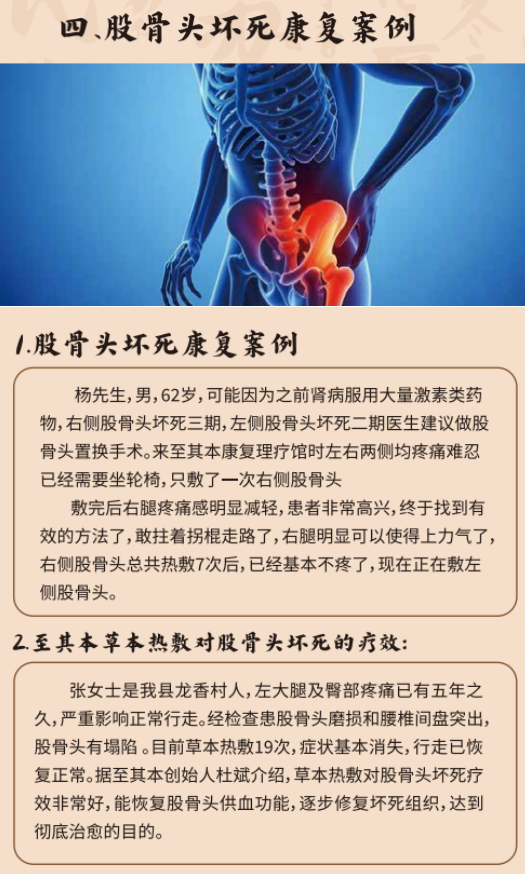 肩周炎康复案例展示，患者接受中药热敷治疗过程，医护人员专业指导，体现治疗效果