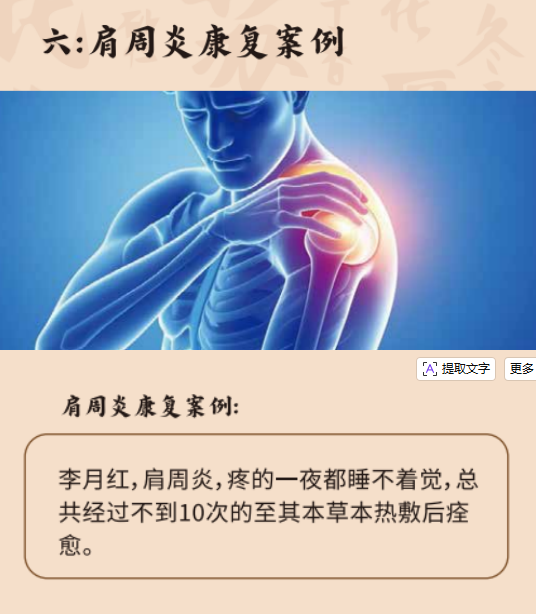 肩周炎康复案例展示，患者接受中药热敷治疗过程，医护人员专业指导，体现治疗效果